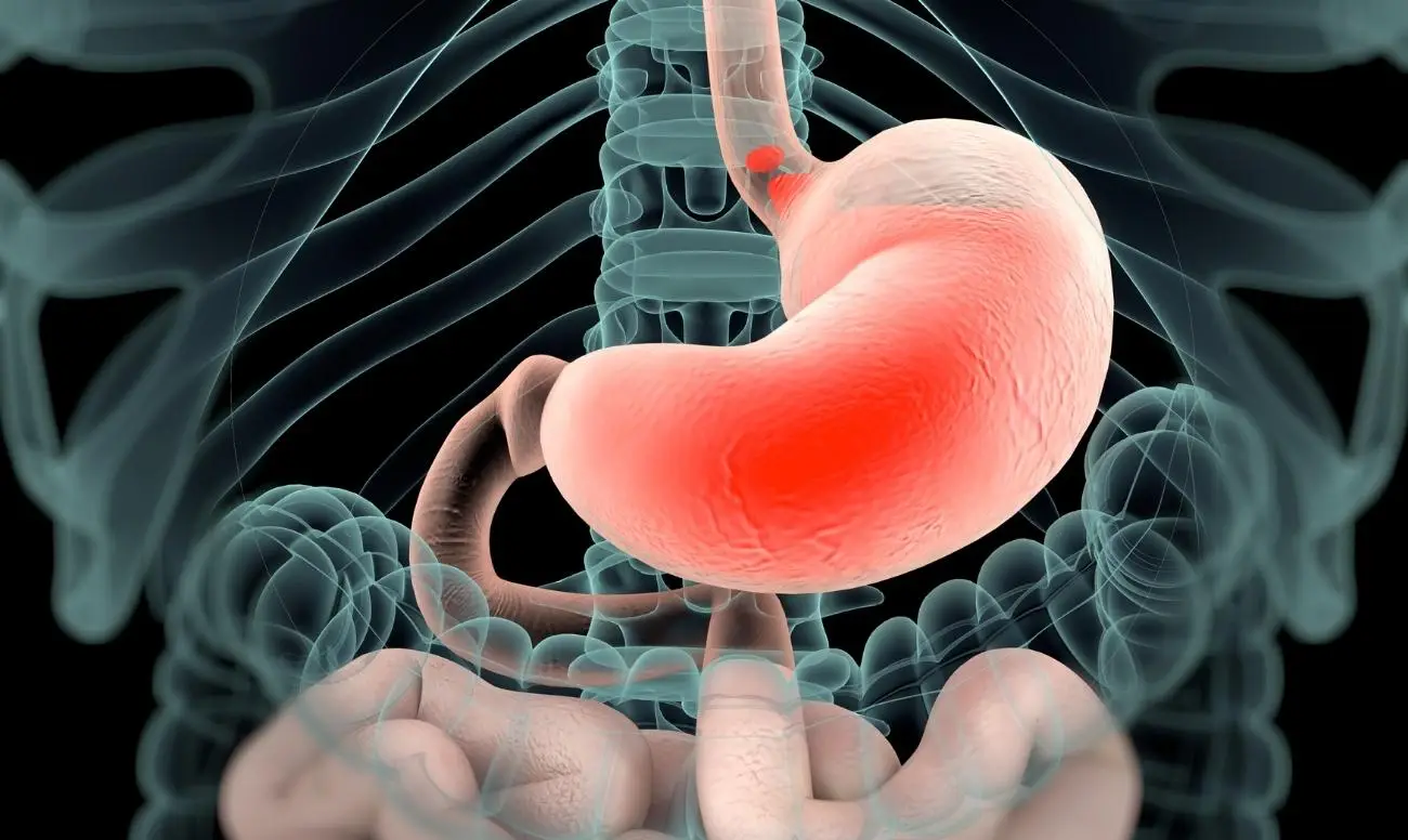 Bevanda naturale per pulire stomaco e intestino: ecco la ricetta per sentirti subito meglio